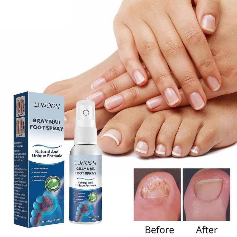 Antifungals Nail Treatments Spray In Medicals Quality, 30 Ml, Antifungals Nail Treatments, Antifungals Spray 30ml