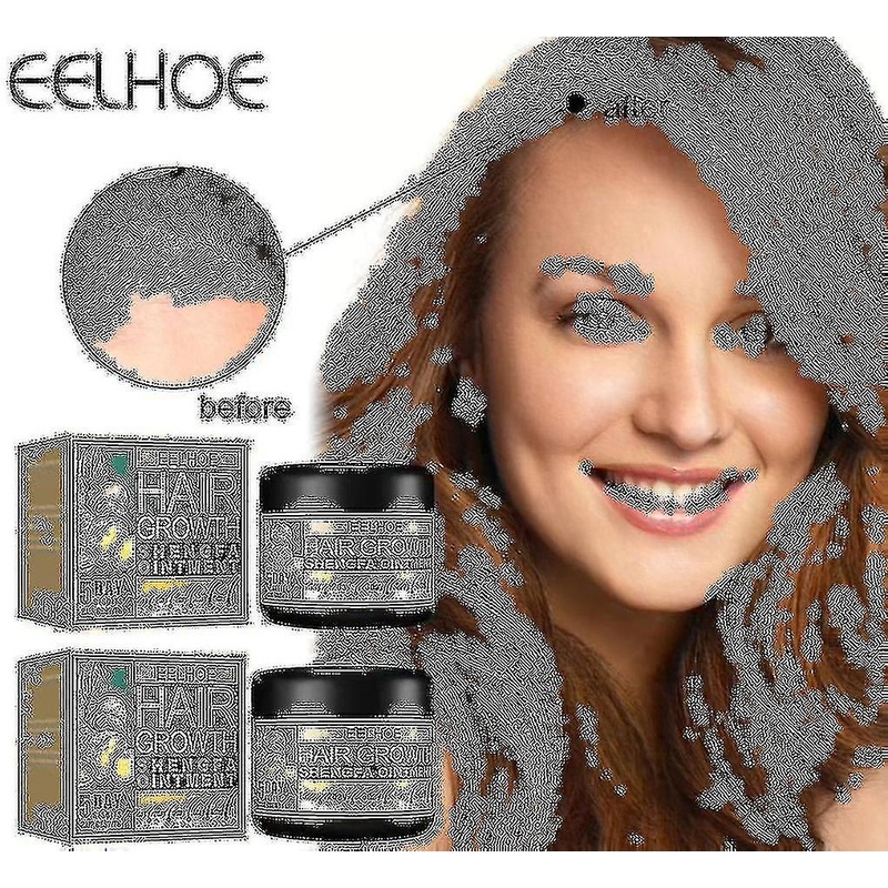 1-3pcs Ginger Hair Growth Ointment Hair Regrowth Serum Natural Hair Loss Treatment