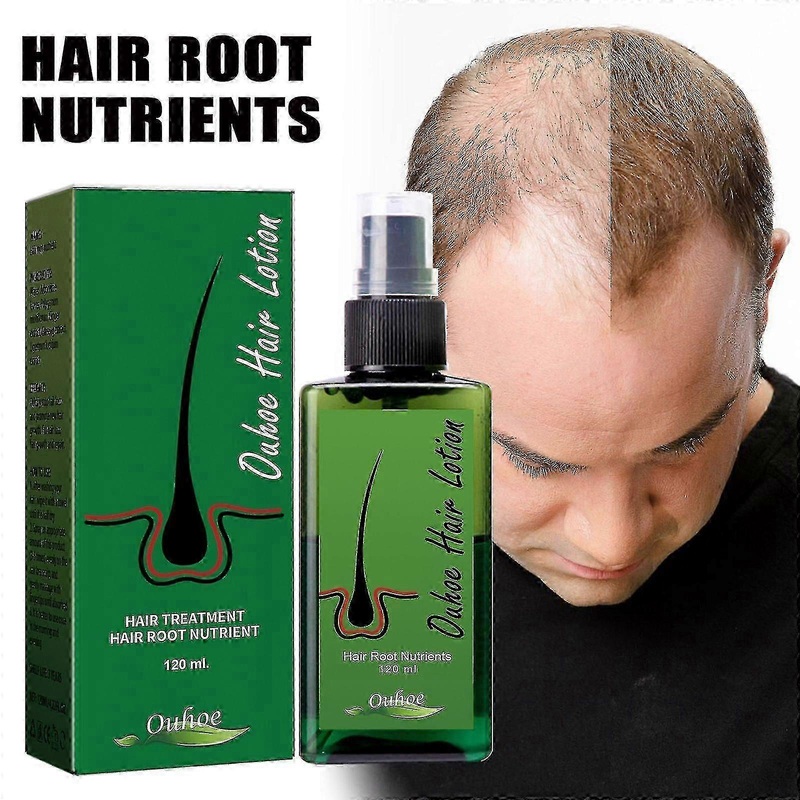 Ouhoe Dense Hair Spray Hair Anti-fall Solid Hair Care Hair Strong Hair Repair Hair Root Hair Care Spray-4268046639912