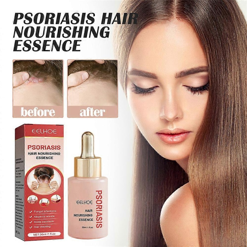 1/2Pcs 30ml Psoriasis Hair Nourishing Essence, Deep Cleansing Hair Regrowth Serum