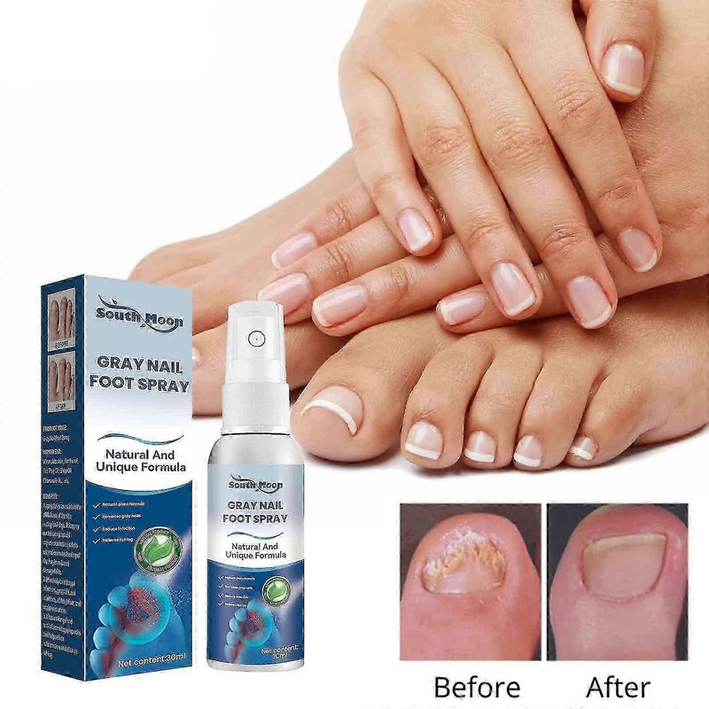 Antifungals Nail Treatments Spray In Medicals Quality, 30 Ml, Antifungals Nail Treatments, Antifungals Spray 30ml_Lucky_B