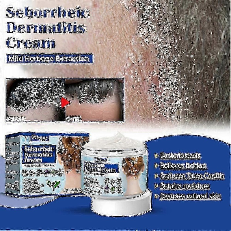 Hair Psoriasis Seborrheic Skin Care Treatments Dermatitis Eczema Head Acne Pruritus Scalp Shampoo Repair Scalp Remove Dandruff