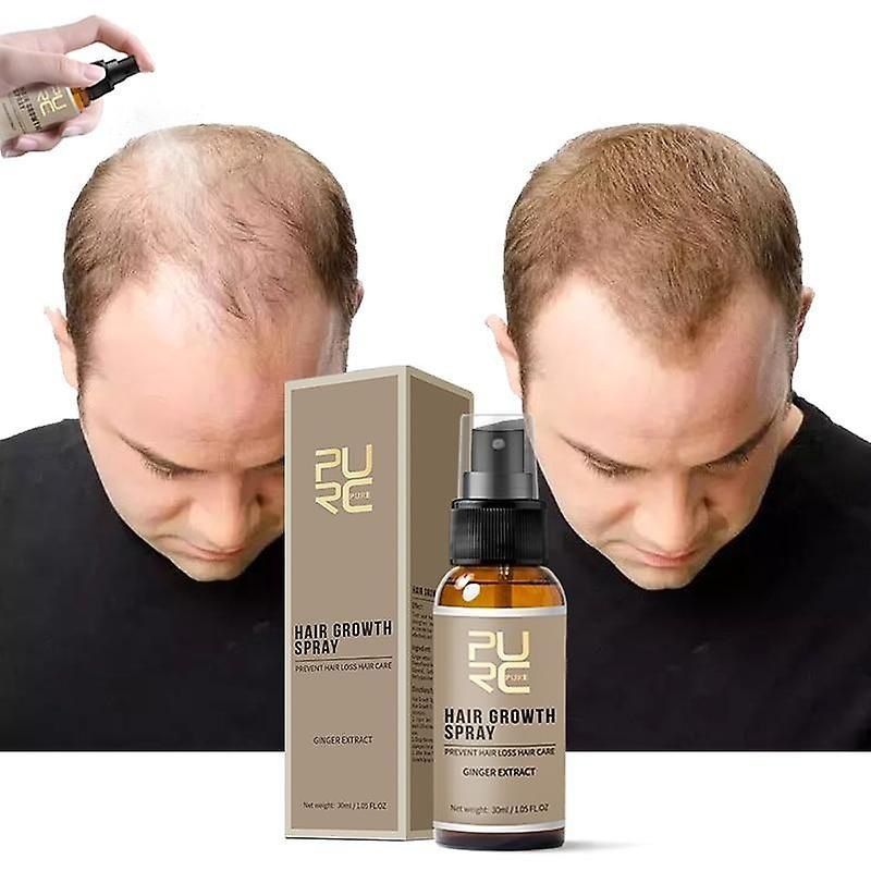 New Hair Growth Spray, Fast Grow Hair Loss Treatment Spray For Man