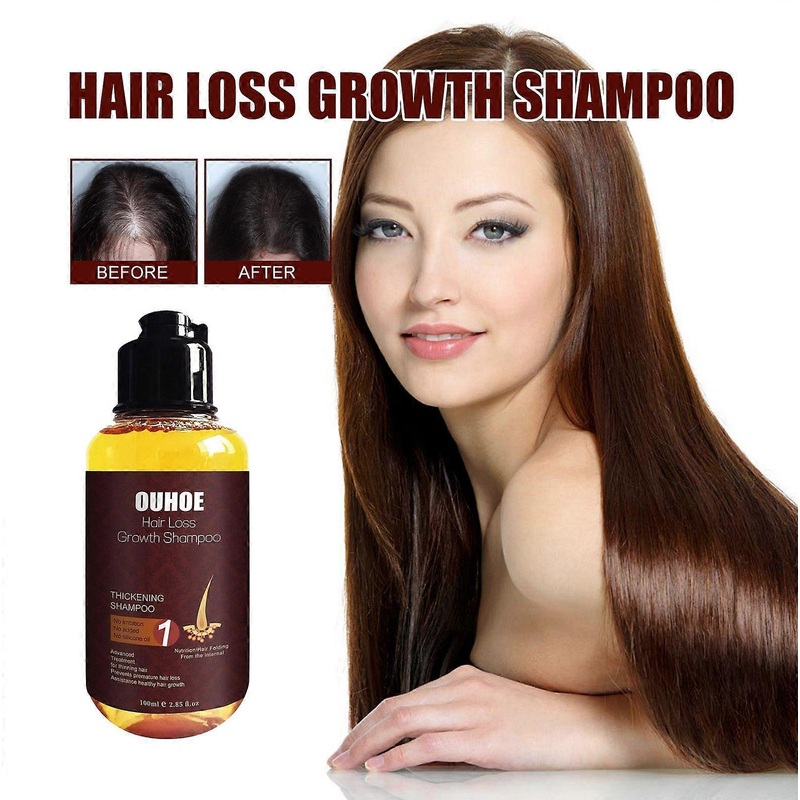Nourishing Nettle & Biotin Shampoo for Healthy, Shiny Hair Growth & Dandruff Control