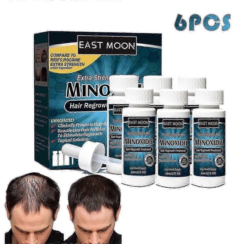 suitable for men 5% extra strength hair regrowth treatment