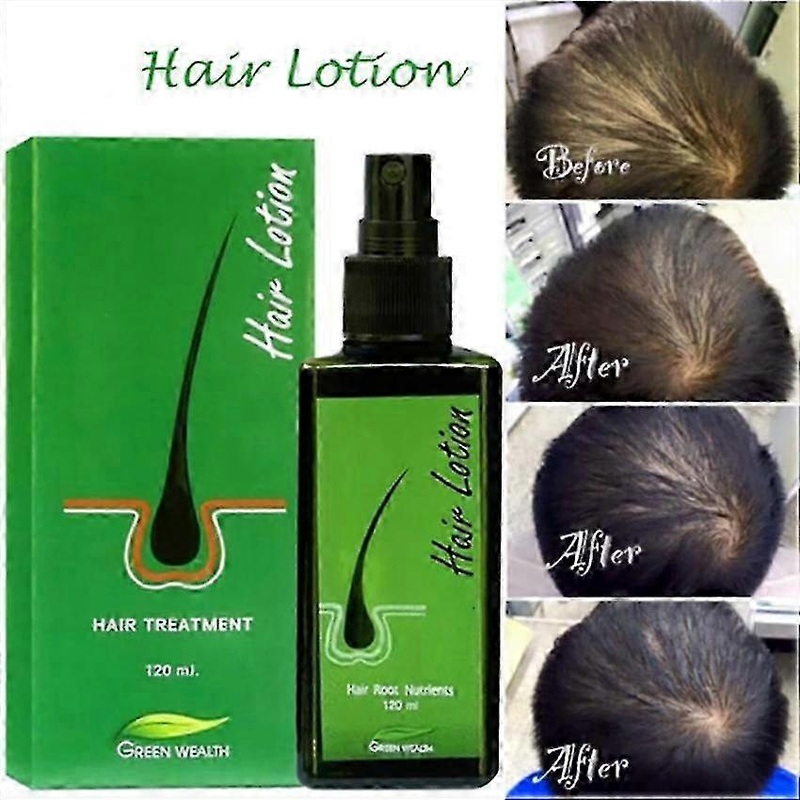 2025 120ml Hair Lotion Green Wealth Growth Root Hair Loss Sideburns Treatment