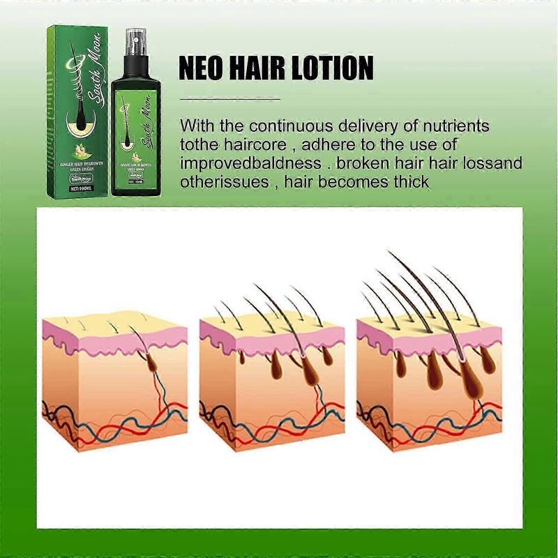 2025 Ginger Hair Growth Serum Liquid for Thin Hair and Hair Loss Hair Growth Hair Growth Serum 100ml Anti-Hair Loss Hair Serum