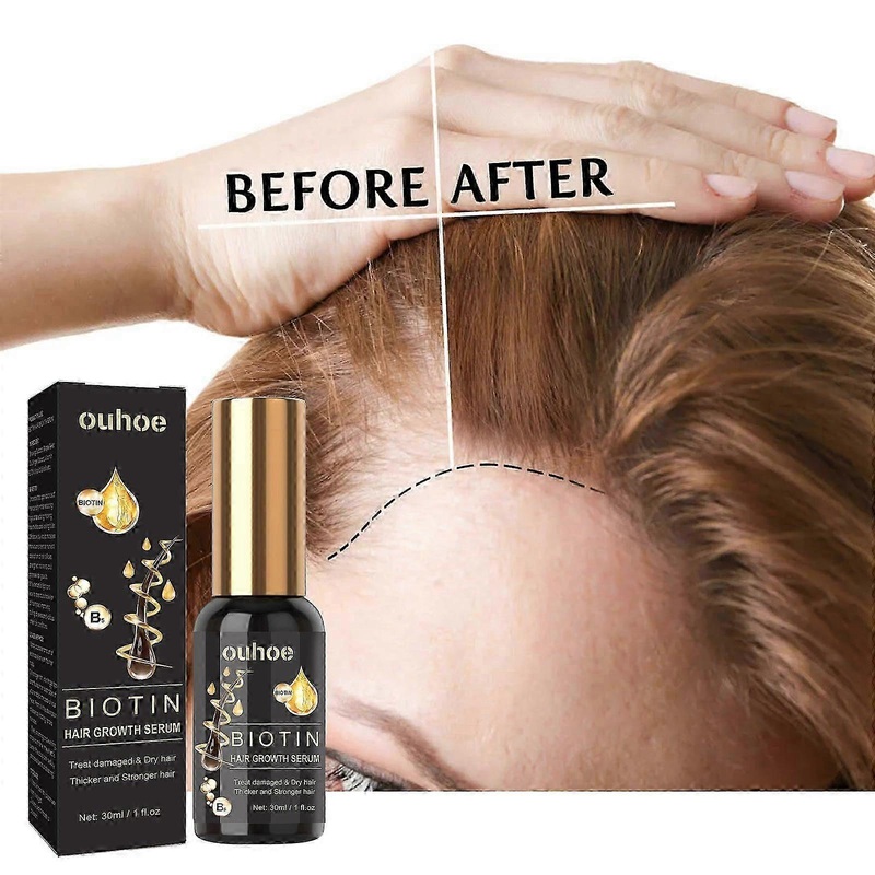 OUHOE Biotin Hair Essence for Strengthening and Repairing Hair, Moisturizing the Interhair Lines, and Thickening the Hair Roots