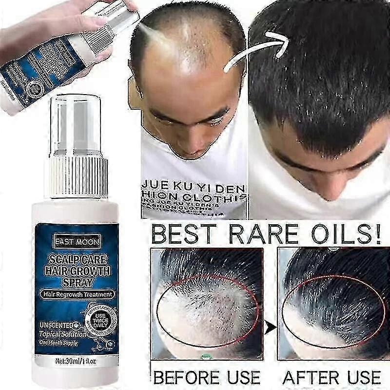 Powerful Hair Growth Serum Spray Prevent Hair Loss Essential Oil Fast Growing Repair Nourish Scalp Treatment For Men Women 30ml 2025
