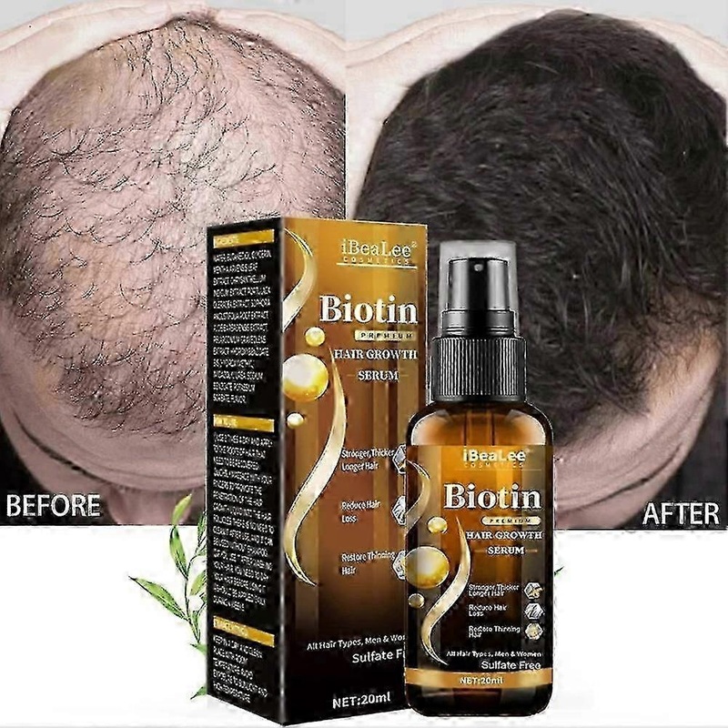 2025 Biotin hair growth spray anti hair loss fast regeneration scalp treatment essence