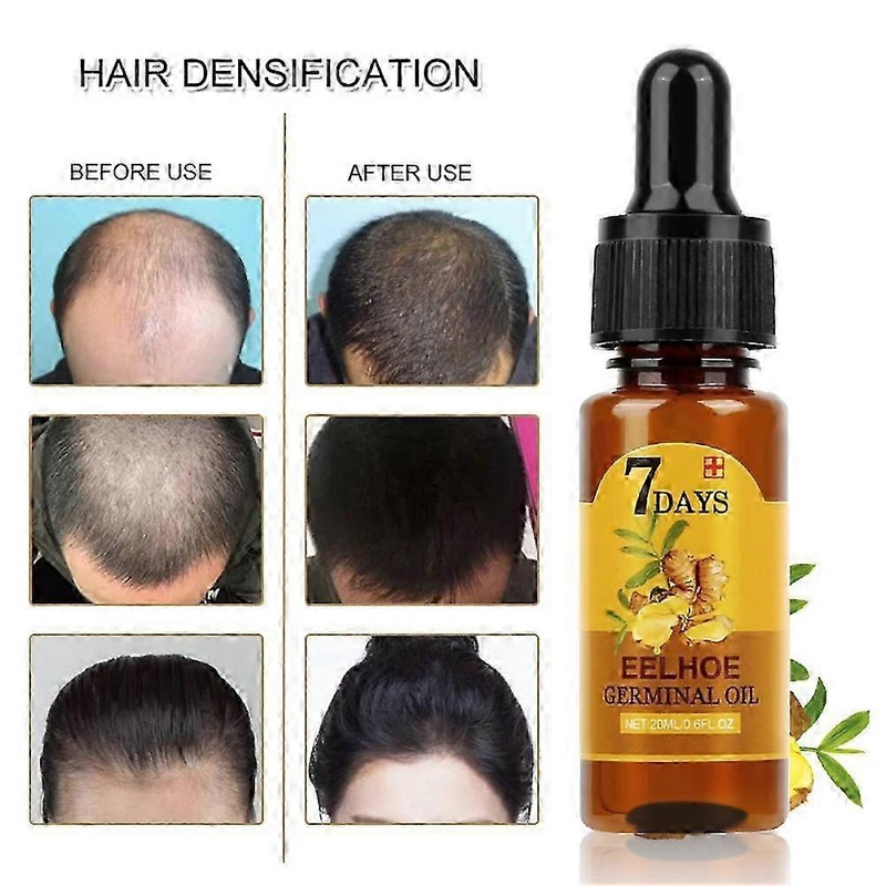 2025 Effective hair loss treatment conditioner natural ginger plant oil fast-growing