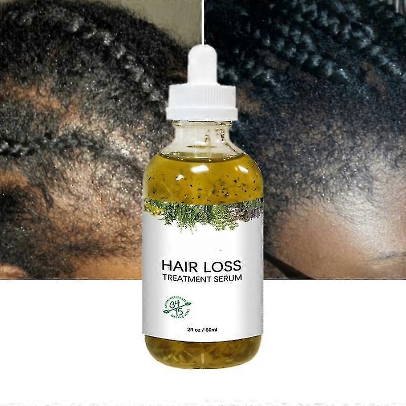 2025 New Fast Hair Growth Serum African Crazy Regrowth Traction Alopecia Hair Loss Prevent Edges Bald