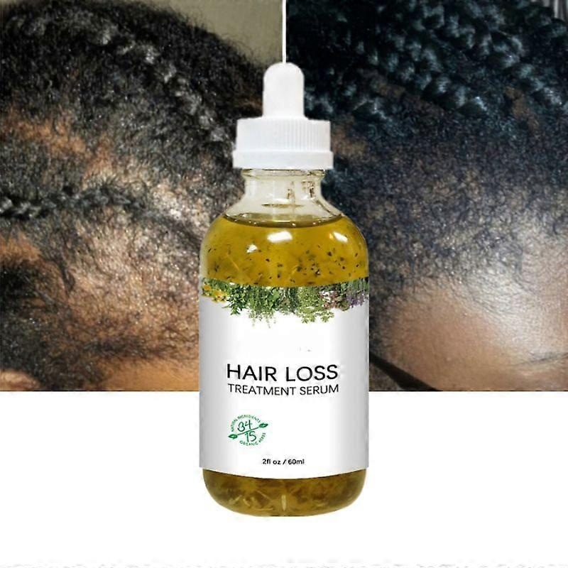 New Fast Hair Growth Serum African Crazy Regrowth Traction Alopecia Hair Loss Prevent Edges Bald