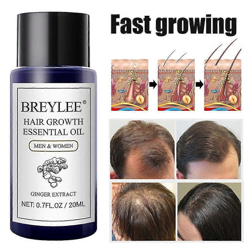 1/2pcs 20ml Hair Care Essential Oil Hair Loss Treatment Hair Growth Essence Oil Hair Care