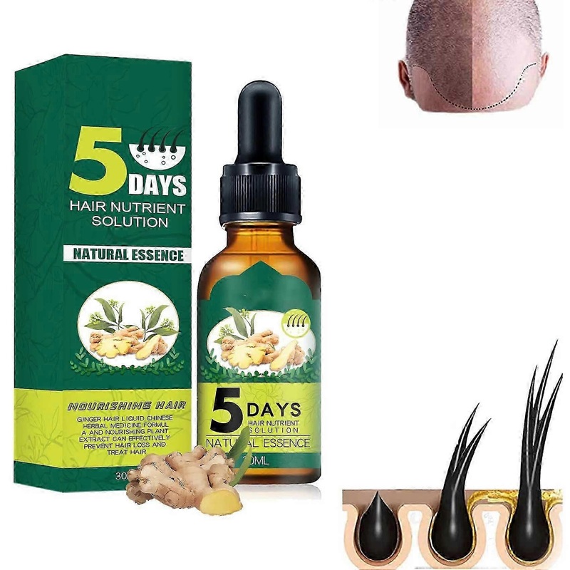 2 Pcs 30ml Essence Hair Growth Oil, Ginger Germinal Oil Hair Growth 5 Day for Hair Regrowth Treatment