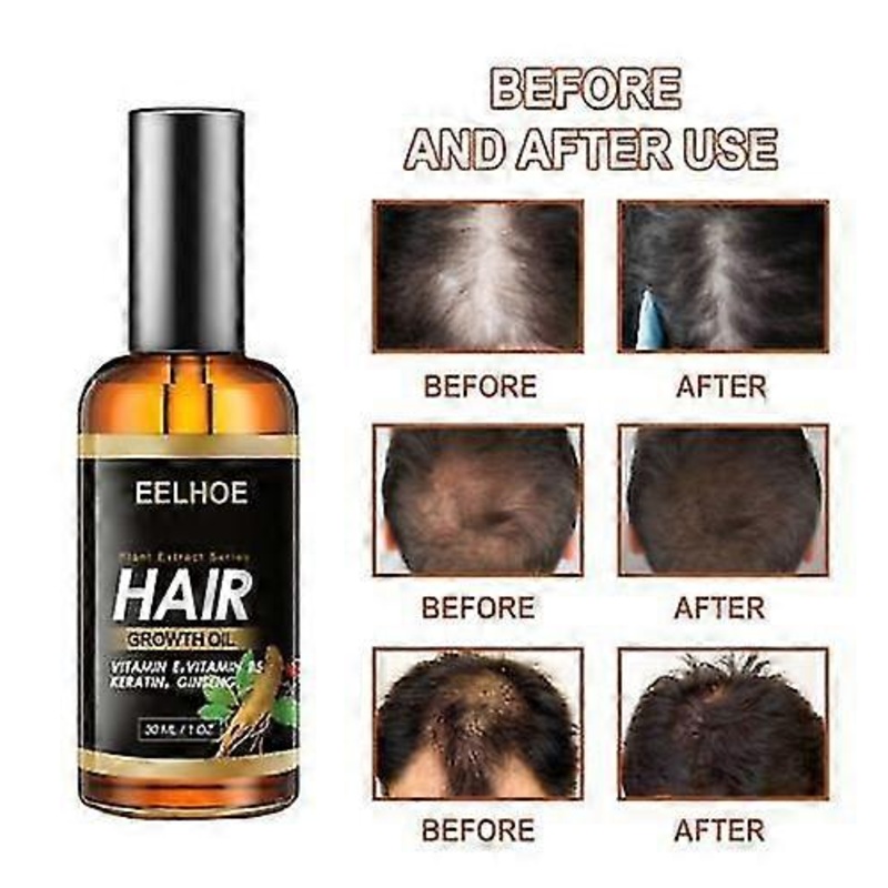 Plant Extract Hair Growth Oil, For Stronger Thicker Longer Hair