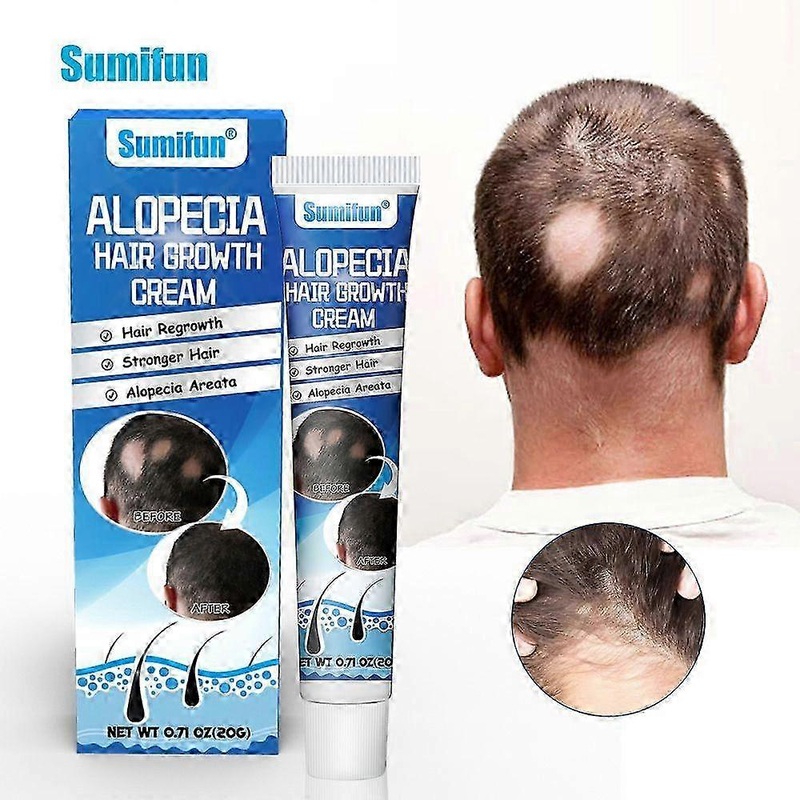 Hair Growth Set, Hair Growth Grease, Scalp Nourishing Grease, Thickening and Strengthening Formula, Lightweight and Non-Greasy Texture, for Men and Wo