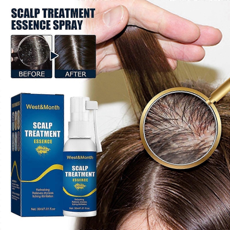 West&Month Hair Care essence spray Hair Care Repair Hair Follicle Damage Hair Root Care spray