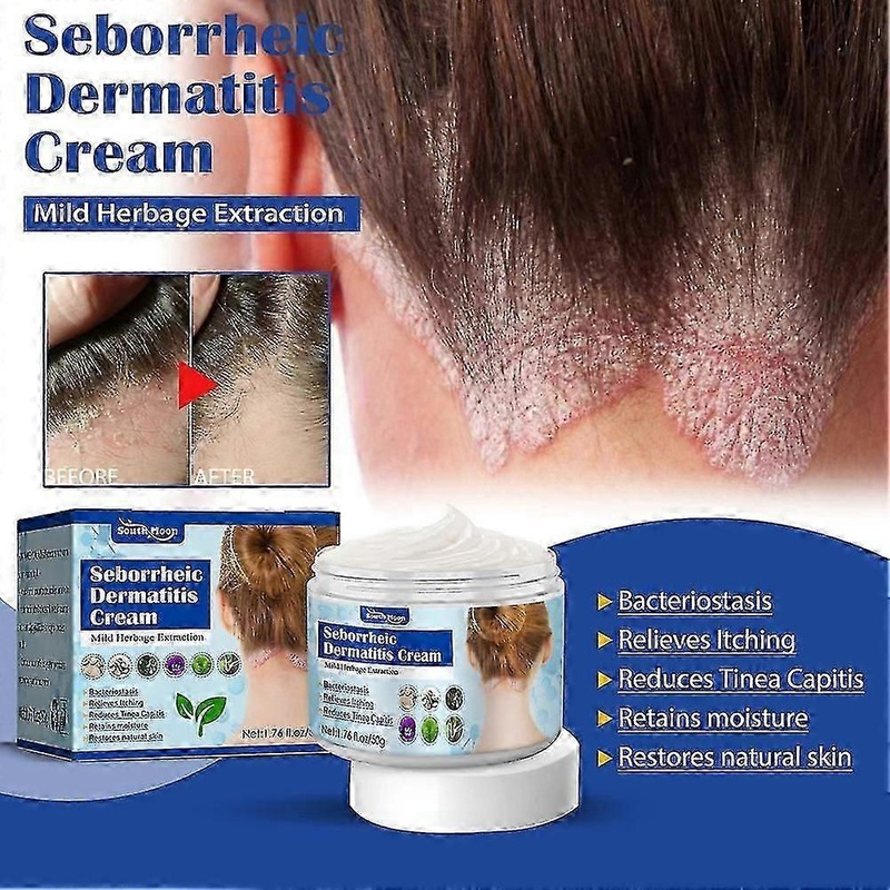 50g Hair Psoriasis Seborrheic Cream Head Skin Care Treatments Dermatitis Eczema Shampoo Hair Pruritus Scalp Treatments Creams (PrettyJ)