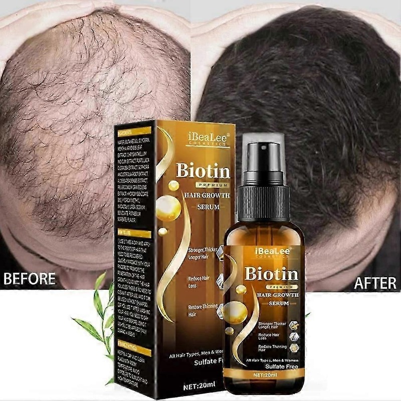 Biotin Anti Fast Regrowth Scalp Serum