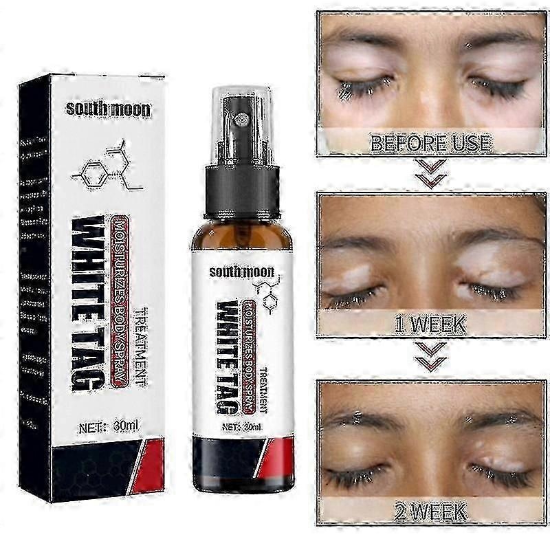 South Moon Vitiligo Treatment Spray
