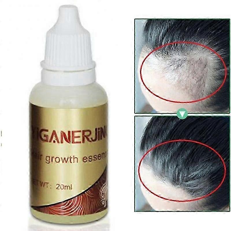 20ml Natural Extract Liquid Hair Conditioner Hair Loss Essential Oils for scalp Nourishing