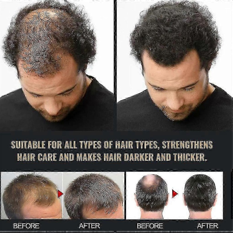Root Activator Shampoo for stronger hair 3pcs