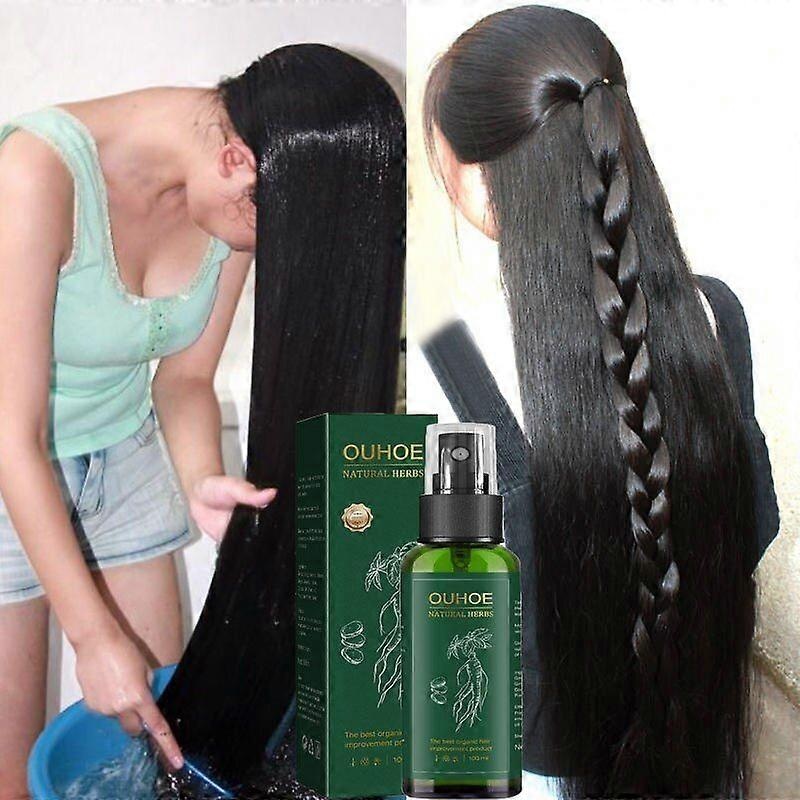 100ml Hair Growth Spray Care Nutrient Solution Strengthens Anti-Hair Loss Moisturizes Roots Thick Improve