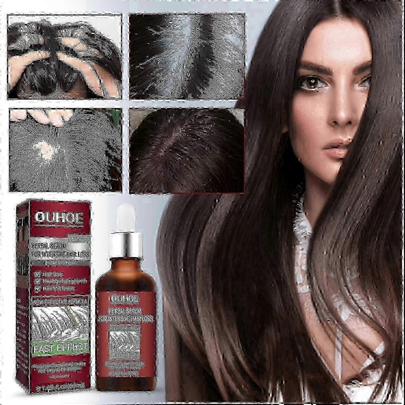 OUHOE Hair Intensive Essence, Moisturizes Hair Roots, Fast Growing Prevents Loss And Strengthens Hai
