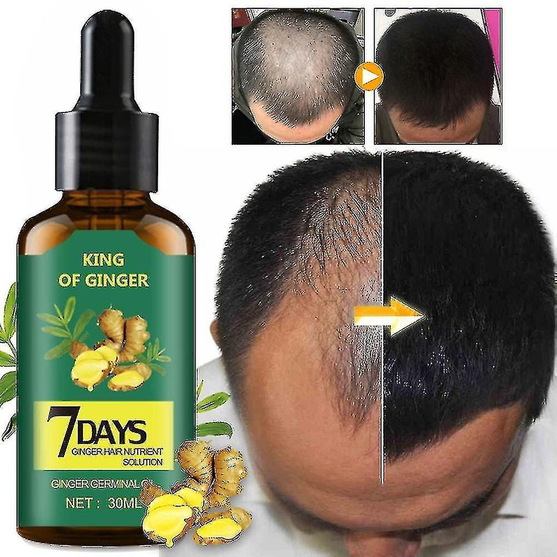 1-3pcs Fast Hair Growth Ginger Hair Growth Serum Hair Care Hair Loss Treatments Dad Gift