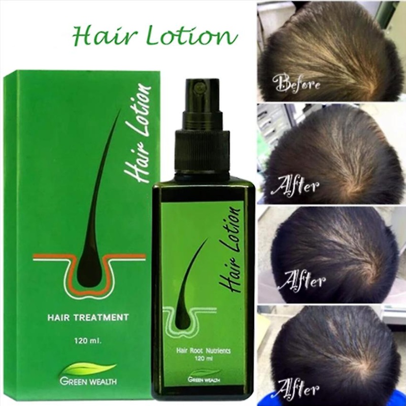 120ml Hair Lotion Green Wealth Growth Root Hair Loss Sideburns Treatment