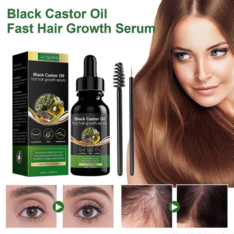 Black Castor Oil Fast Hair Growth Serum Ginger Mint Oil 60Ml Clearance