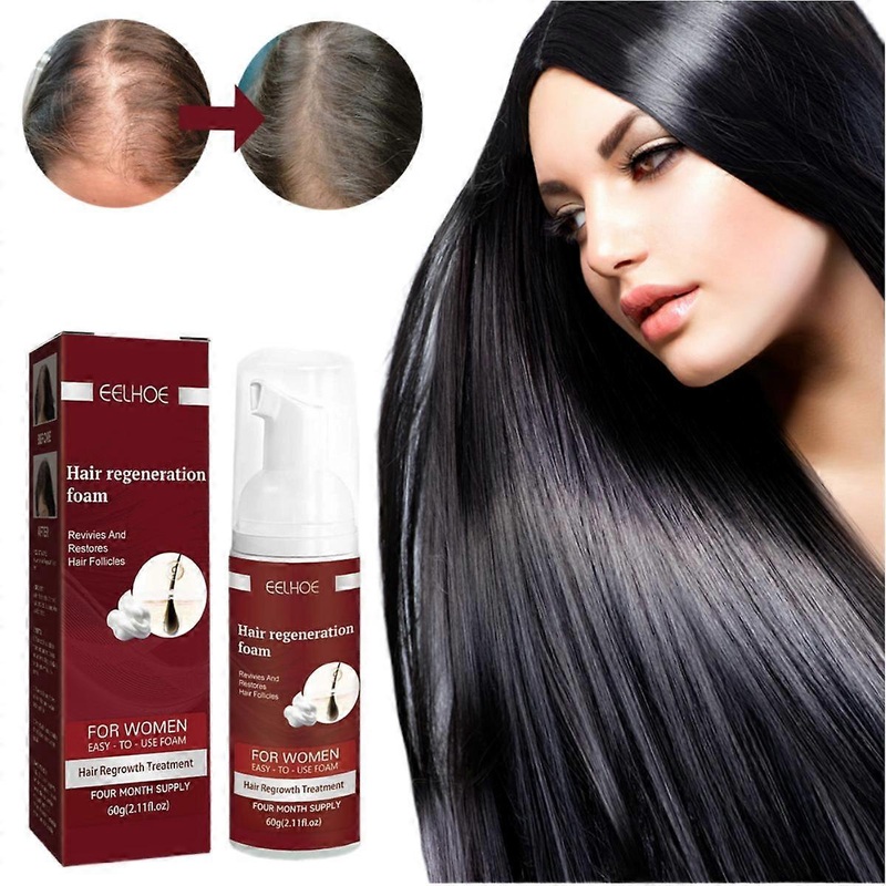 Women Bangs 5% Foam For Thinning Hair And Hair Loss, Hair Regrowth Treatment
